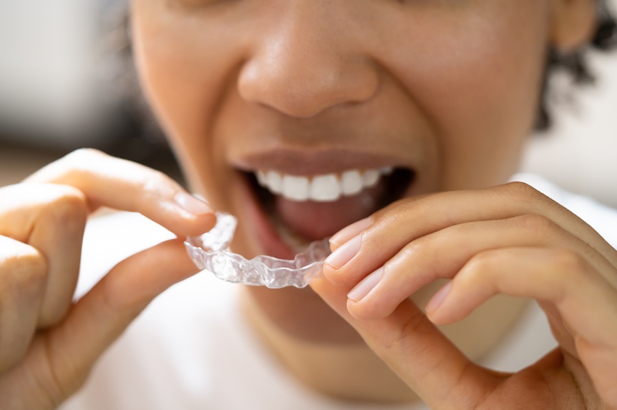 Straighten Your Smile: The Journey with Clear Aligners