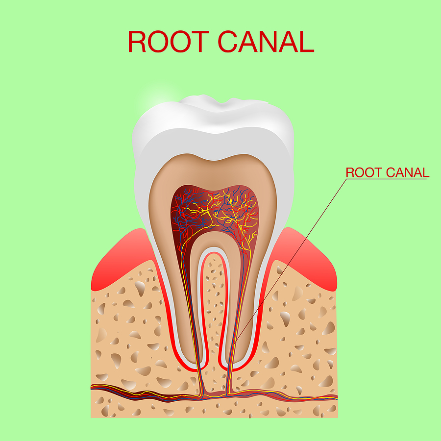 Can a Root Canal Procedure Save My Tooth?