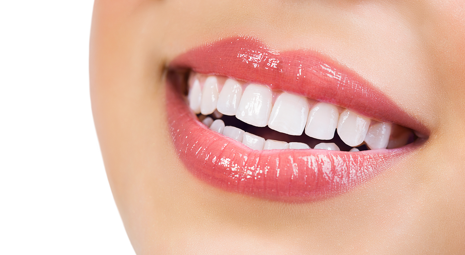 Achieve a Radiant Smile with Teeth Whitening in Boise, ID